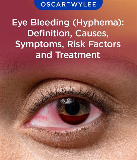 blood leaking from eye|Eye Bleeding Symptoms, Causes, and Treatment